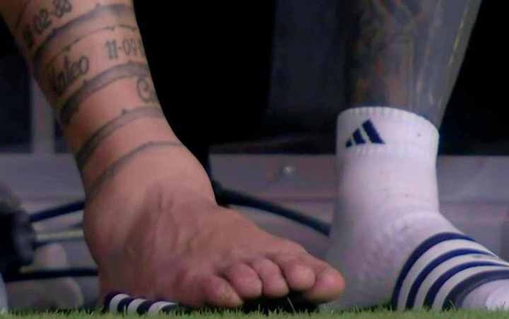 Cận cảnh cổ chân bị sưng to của Messi.