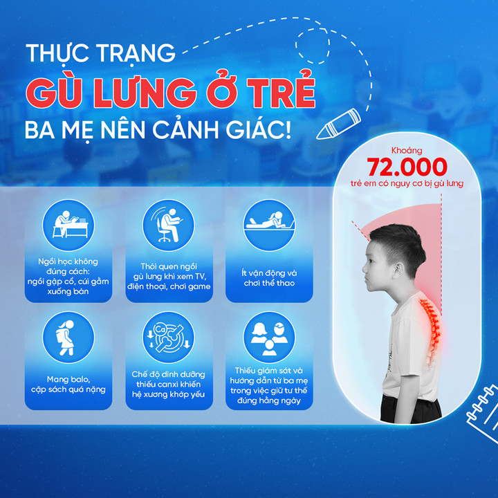 Thực trạng gù lưng ở trẻ em hiện nay.