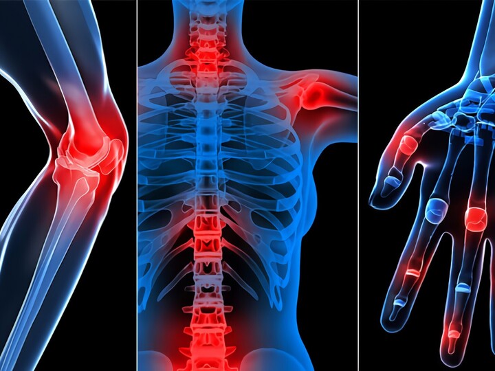 Dấu hiệu đáng cảnh báo về các bệnh đau nhức xương khớp.