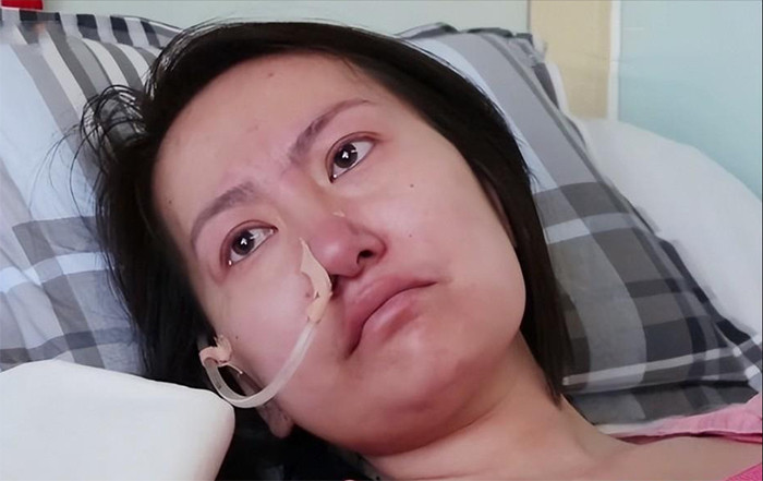 Vương Duyệt trong những ngày nằm trên giường bệnh. (Ảnh: Toutitao)