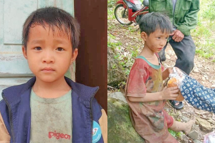 Bé Lâm gầy gò, xanh xao, sụt 4kg sau 5 ngày đi lạc trong rừng.