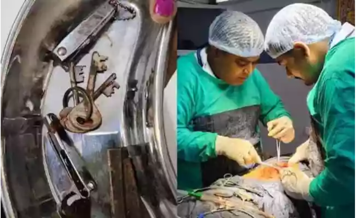 Các bác sĩ đã lấy ra chìa khóa, bấm móng tay và thậm chí cả một con dao từ dạ dày của một nam thanh niên. (Ảnh: New York Post)