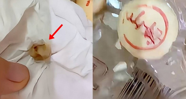 Chiếc răng người trong nhân bánh trung thu khiến nhiều người phẫn nộ.