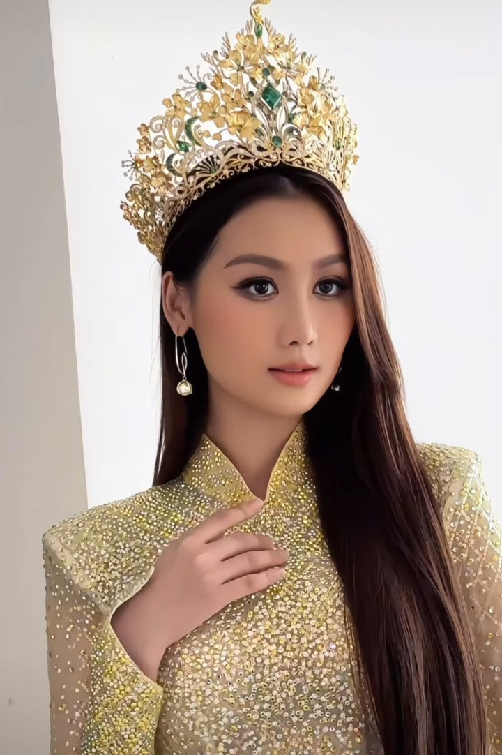 Quế Anh bị nghi "dao kéo".