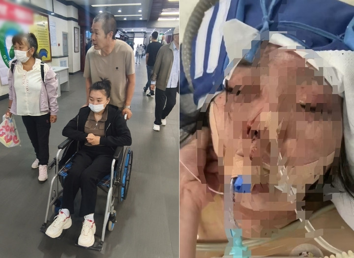 Hiện tại, Tiểu Tuyết mất khả năng tự chăm sóc bản thân, phải phụ thuộc hoàn toàn vào bố mẹ.