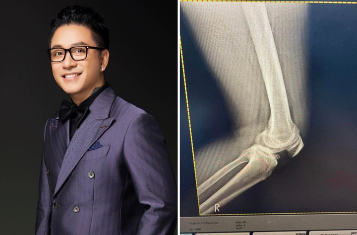 Tuấn Hưng gặp chấn thương ở chân.