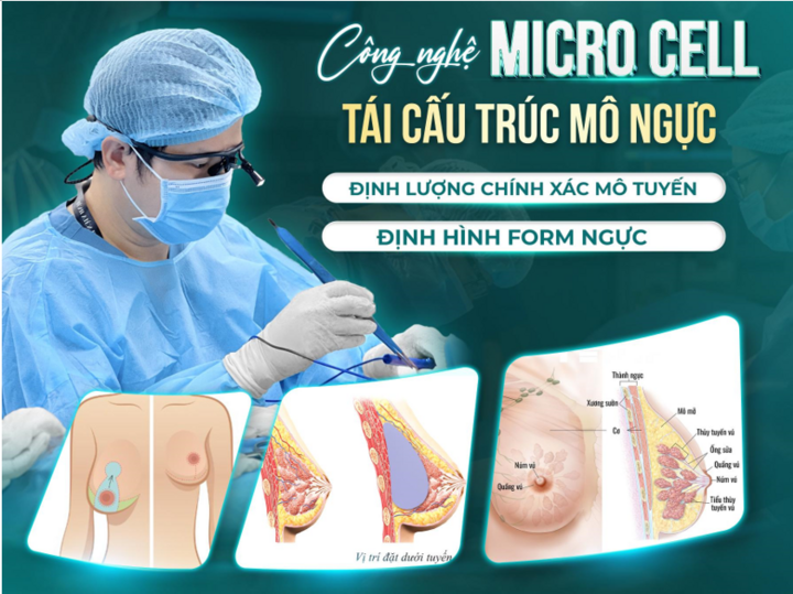 Độ bền của ngực sa trễ phụ thuộc rất nhiều vào kĩ thuật của bác sĩ.