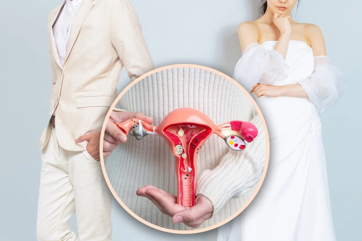 Vợ giấu bệnh tâm thần và cắt bỏ tử cung, tòa án chấp thuận cho chồng hủy hôn. (Ảnh: SCMP)