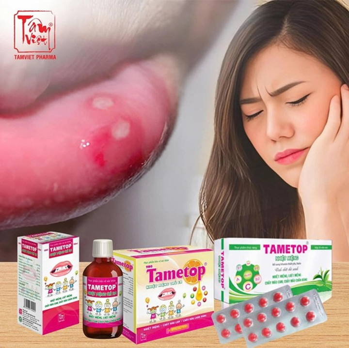 Tametop - hỗ trợ loại bỏ nhiệt miệng, phục hồi vết loét nhanh chóng.