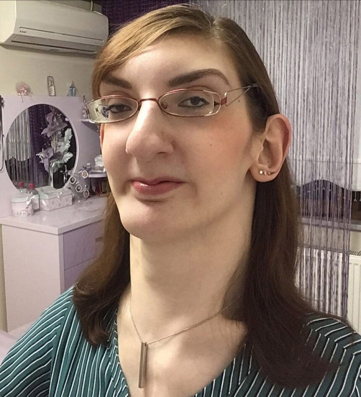 Rumeysa thường dựa vào xe lăn hoặc xe tập đi để di chuyển. (Ảnh: Jam Press)