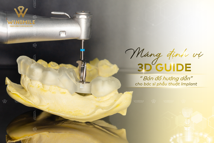 Nha khoa Win Smile ứng dụng loạt công nghệ hiện đại trong trồng răng Implant - 3