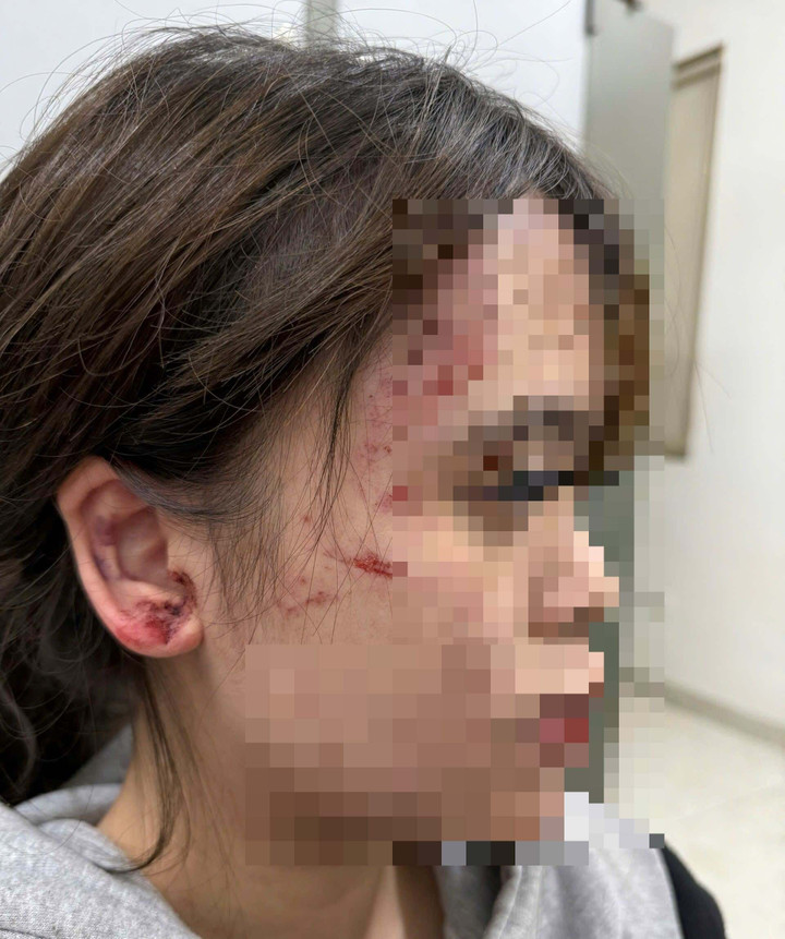 Cô gái bị nhiều thương tích trên cơ thể.