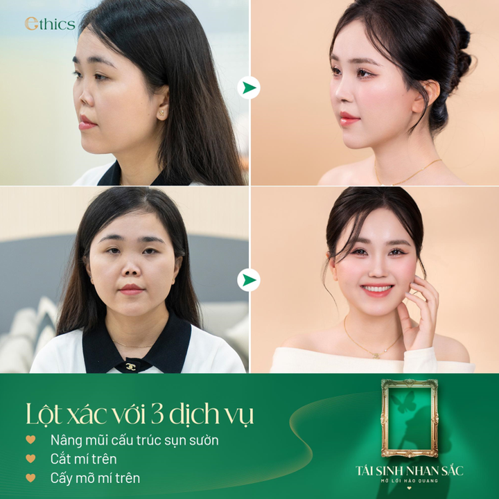 Cơ hội 'phá kén lột xác' với chi phí 0 đồng cùng Thẩm mỹ viện Ethics - 2