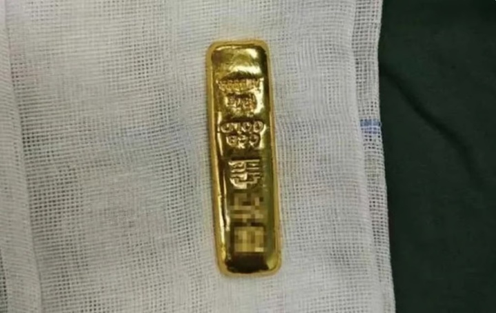 Cận cảnh thỏi vàng mà cậu bé nuốt phải. (Ảnh: Douyin)