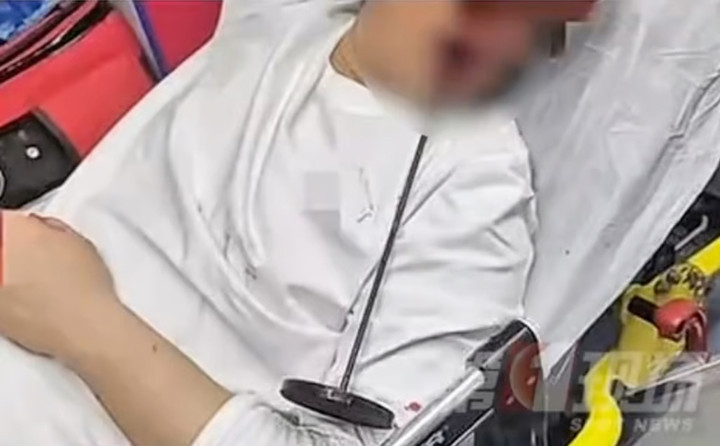 Các bác sỹ mô tả tình trạng của Aqiang khá hiếm gặp. (Ảnh: QQ.com)