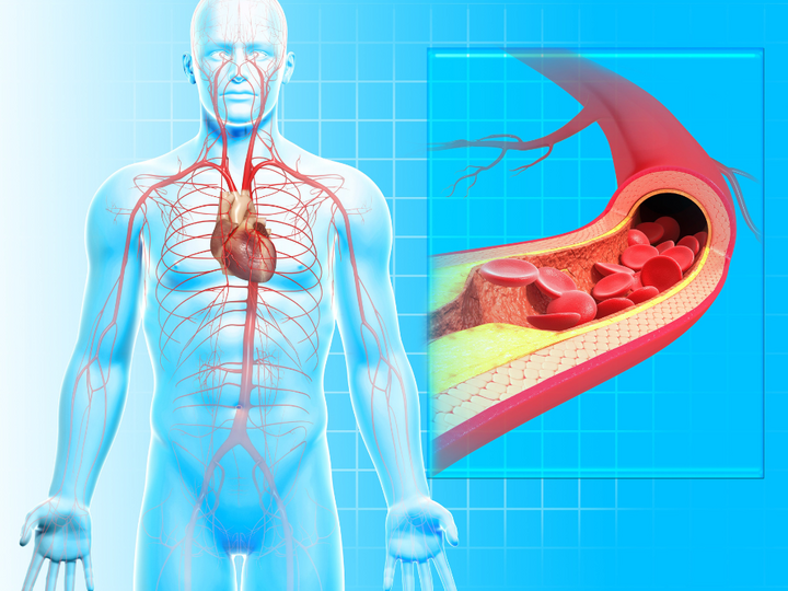 Mạch máu sạch là điều kiện để nâng cao tuổi thọ.