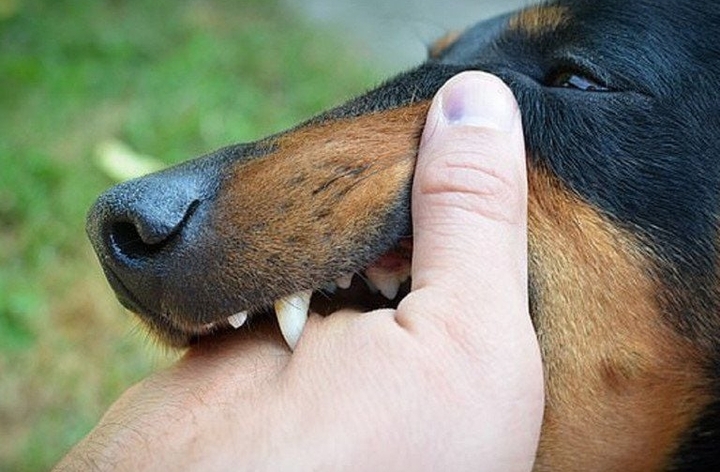 Uống thuốc nam sau khi bị chó cắn, bé trai 13 tuổi nguy kịch