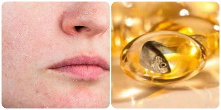 Omega-3 là dưỡng chất cần thiết cho cơ thể