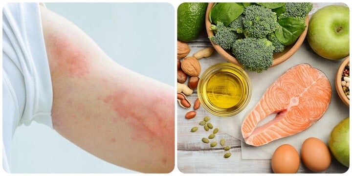 Khi cơ thể có dấu hiệu thiếu Omega-3 bạn cần lên kế hoạch bổ sung ngay.