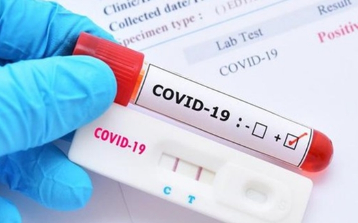 83% mẫu COVID-19 tại TP.HCM là biến chủng mới NB.1.8.1