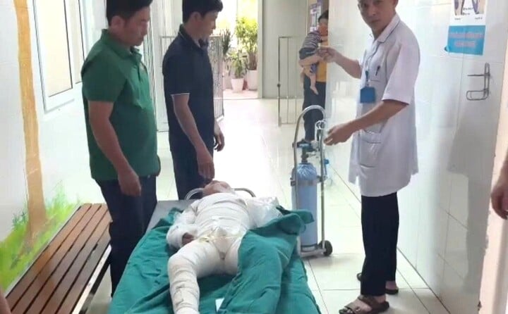 Cháu A. bị bỏng khắp người.