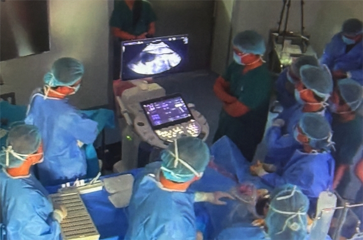 Bào thai 600 gram thoát cửa tử nhờ can thiệp tim thành công
