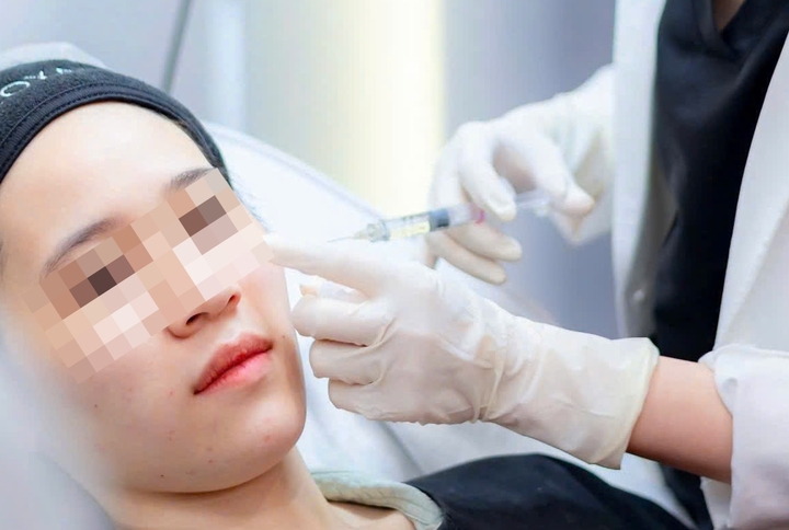 Cách nhận biết filler giả