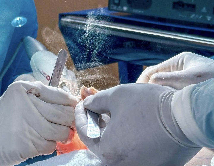 Ngực tái sa trễ: Nguyên nhân, dấu hiệu, phương pháp thẩm mỹ phù hợp