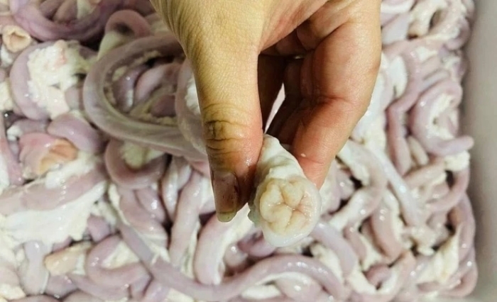 Người phụ nữ bán lòng lợn nhiễm liên cầu khuẩn