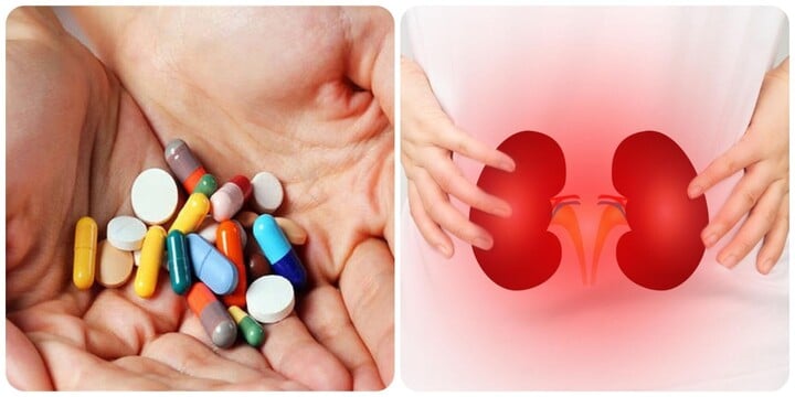 Lạm dụng thuốc giảm đau bừa bãi có thể gây ra bệnh thận