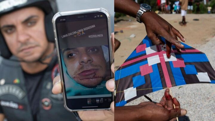 Những sợi dây diều rất sắc dễ dàng cắt đứt tay người cầm. (Ảnh: AFP)