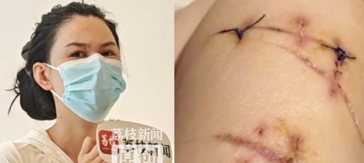 Ma bị đâm 22 nhát dao nhưng thoát chết nhờ túi độn ngực. (Ảnh: Handout)