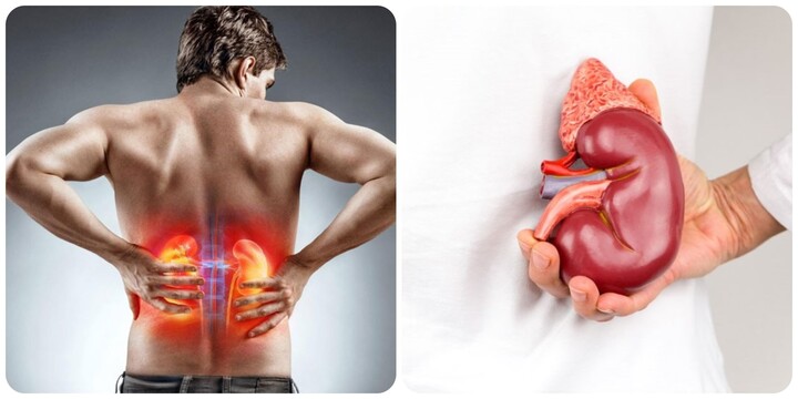 Dấu hiệu suy thận ở nam giới không nên chủ quan