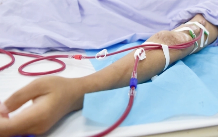 Suy thận ở tuổi 32 sau nhiều năm lạm dụng sản phẩm tăng cơ