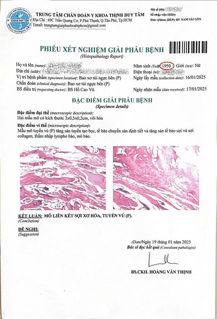 Tháo túi ngực, mê mask thanh quản - 1