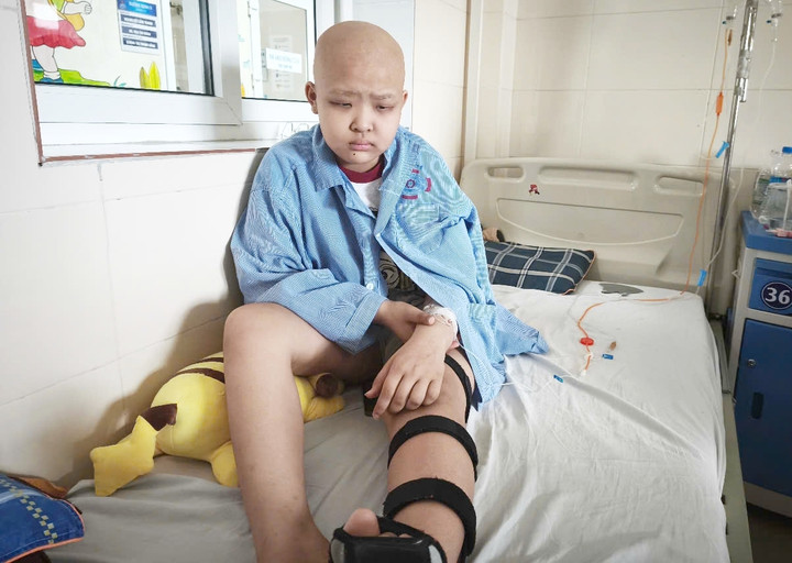 Mai Linh bất lực bên giường bệnh, chân trái được nẹp cứng, gương mặt tái nhợt sau những đợt truyền hóa chất kéo dài.