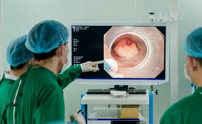 Nội soi là phương pháp giúp bác sĩ chẩn đoán, phát hiện sớm bệnh về đường tiêu hóa.
