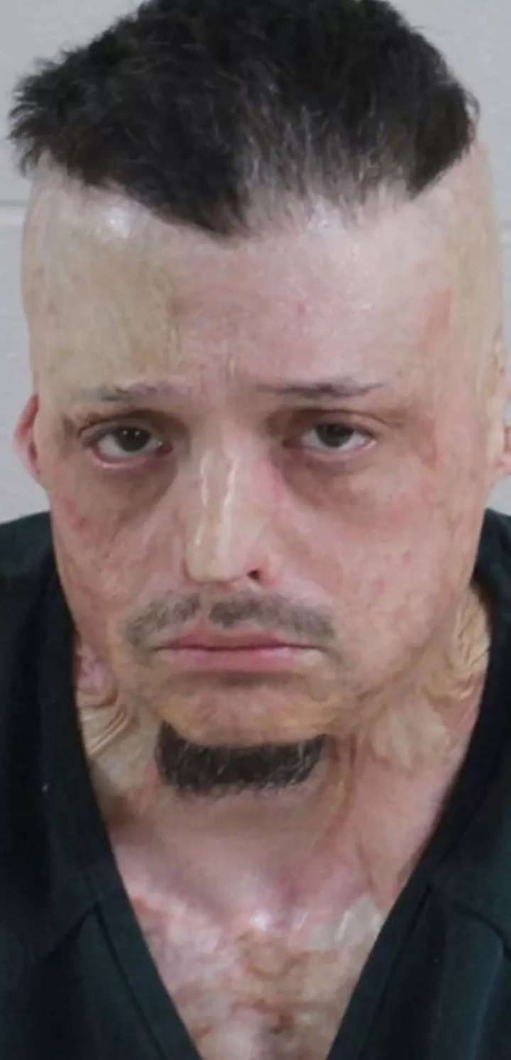 Robert Michalski Jr., chủ con chó đã tấn công cậu bé.