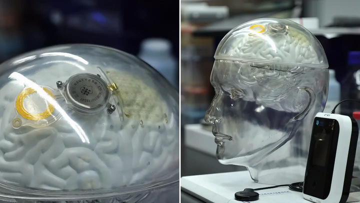 Công nghệ 21/7: Trung Quốc bắt kịp Mỹ trong công nghệ kết nối não bộ