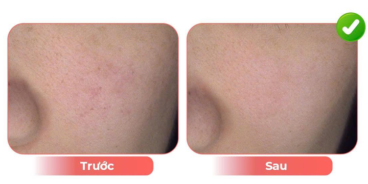 Trẻ hóa da tuổi trung niên bằng chiếu đèn LED - 3