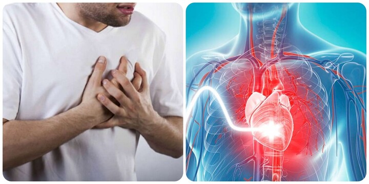 Truỵ tim mạch nếu không được cấp cứu kịp thời thì nguy cơ tử vong rất cao