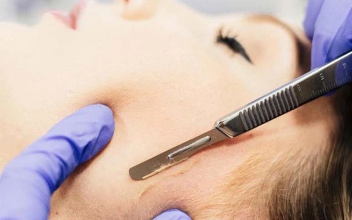 Bác sĩ chỉ cách cạo lông mặt không bị mụn, da mịn như em bé