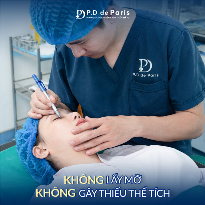 Dàn mỡ mí mắt - giải pháp khắc phục sụp mí, bọng mắt sau 30 tuổi ở PD De Paris - 3
