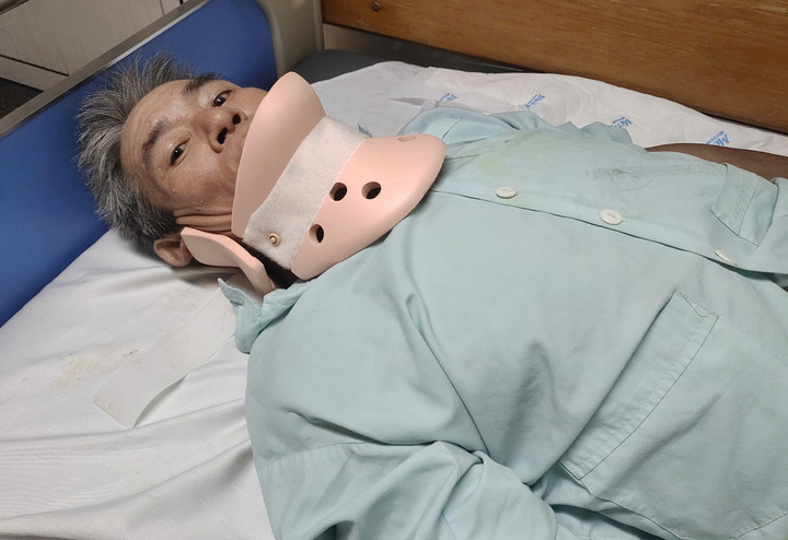 Ông Sinh gãy đốt sống cổ, tụ máu vùng tủy cổ – loại chấn thương cực kỳ nguy hiểm.
