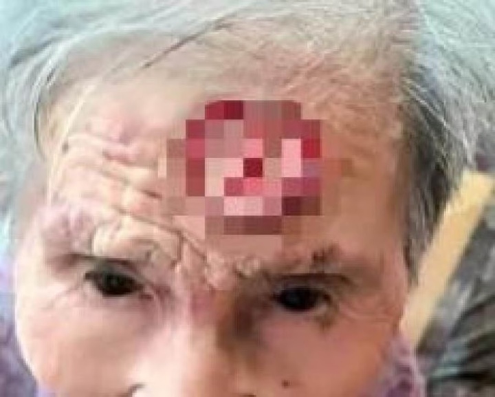 Vết thương do bà Gu tự gây ra chảy máu rất nhiều. (Ảnh: Handout)