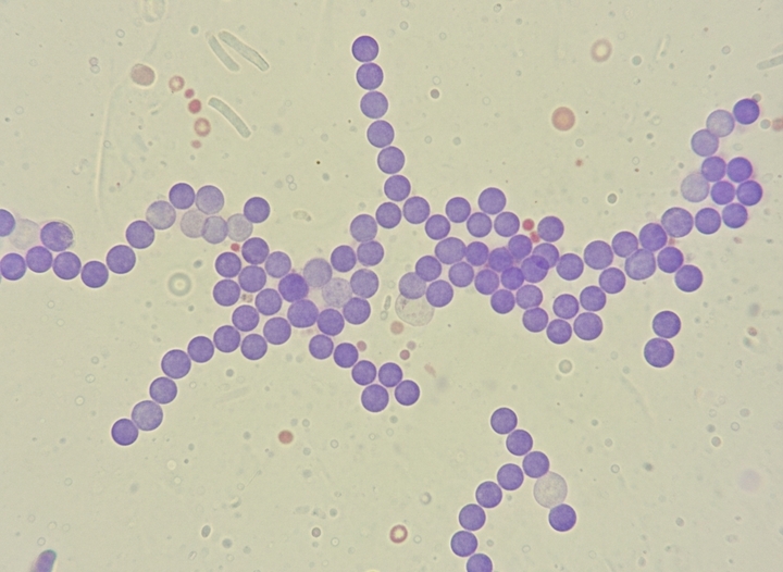 Tác nhân gây bệnh liên cầu lợn là một loại liên cầu khuẩn có tên là Streptococcus suis (S.suis).