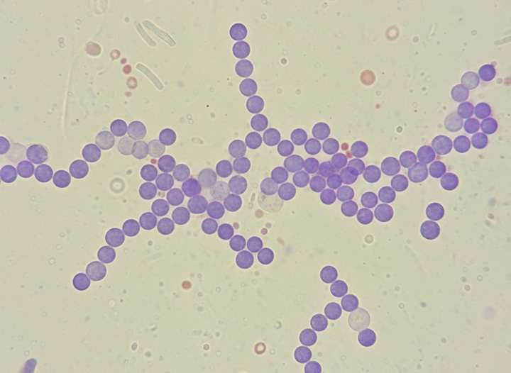 Hà Nội ghi nhận ca nhiễm liên cầu lợn thứ 9 trong năm