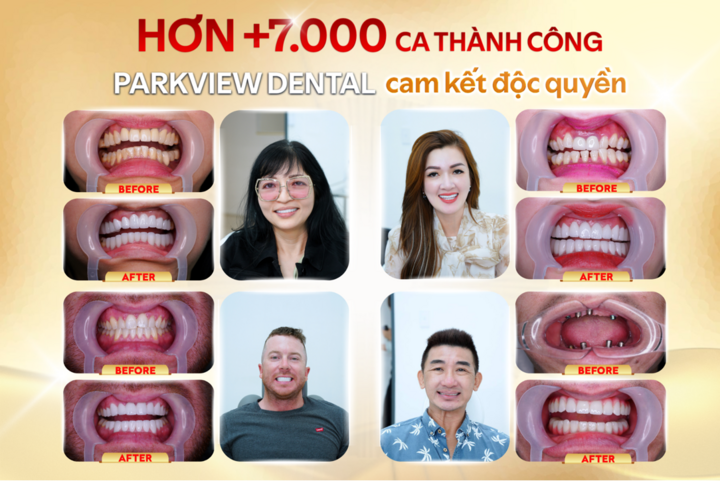 Parkview Dental triển khai giải pháp hỗ trợ hậu phẫu cho khách hàng kiều bào - 3
