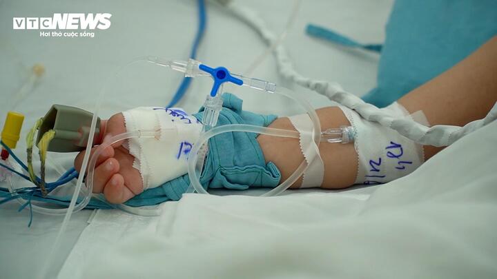 Phụ huynh cần đưa trẻ đến bệnh viện điều trị kịp thời để tránh các biến chứng nặng. (Ảnh: Như Thuý)