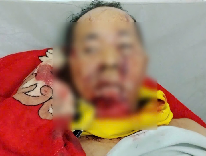 Ông Nh. bị gấu tấn công khi đi làm về.